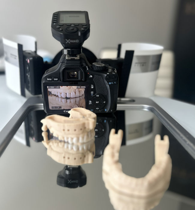 model of teeth with a camera