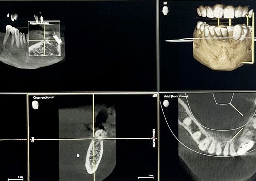 dental scan of jaw