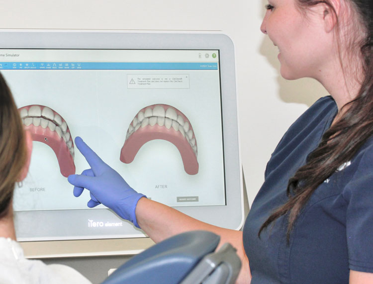 dentist pointing at a dental scan