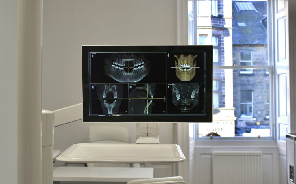 3d scan of teeth on a monitor