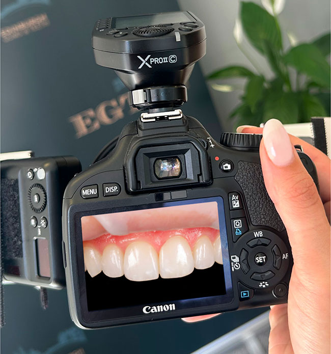 teeth seen through a camera lense