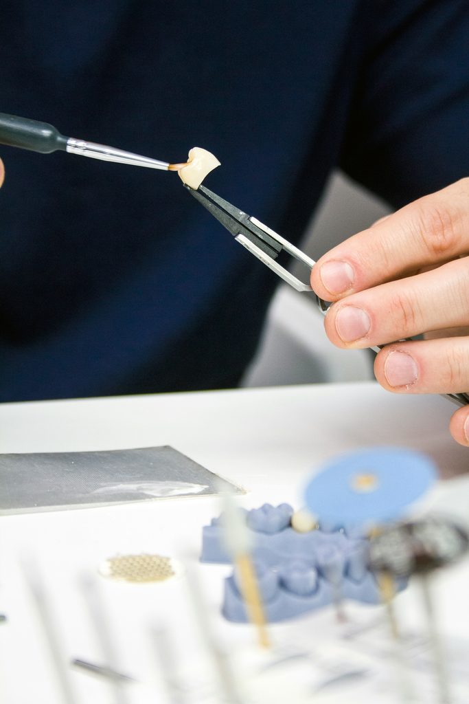 Dentist preparing a dental crown to be placed in a tooth mould before